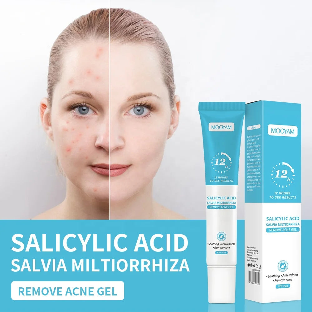 Gel Anti-Acné MOOYAM | Résultats visibles en 12h KAMOTEK